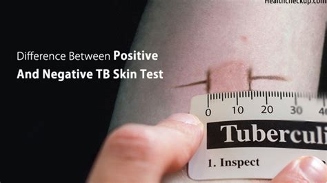 How much are tb tests - Diagnostics & Testing / Tuberculosis (TB) Test. A TB test checks to see if you have been infected with tuberculosis (TB). There are two types of TB tests: a skin test and a blood …